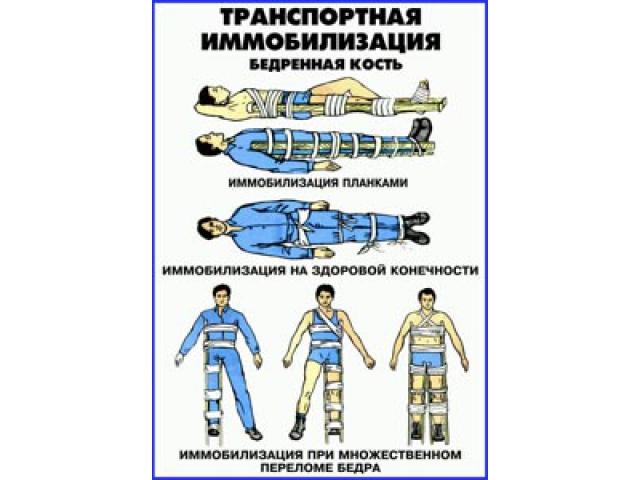 Транспортная иммобилизация Бедренная кость