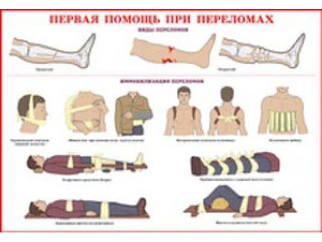 При переломах
