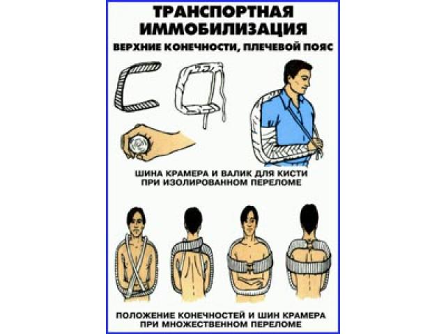 Транспортная иммобилизация Верхние конечности плечевой пояс
