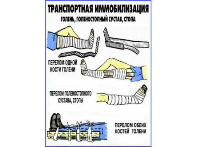 Транспортная иммобилизация Голень голеностопный сустав стопа