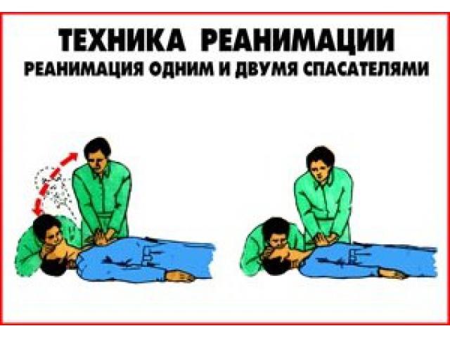 ГОРИЗОНТ Реанимация одним и двумя спасателями