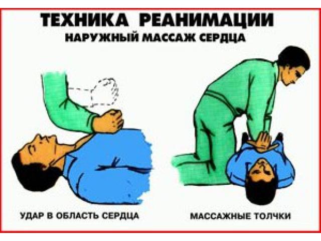 ГОРИЗОНТ Наружный массаж сердца