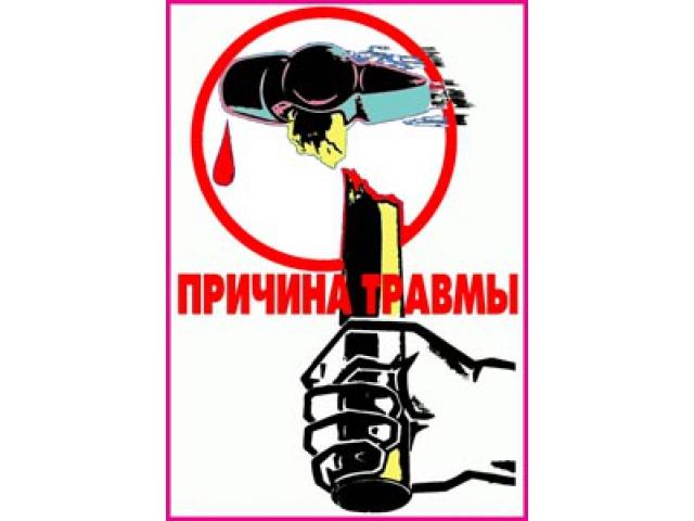 30 Причина травм