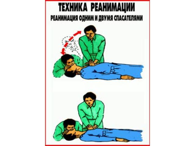 Реанимация одним и двумя спасателями